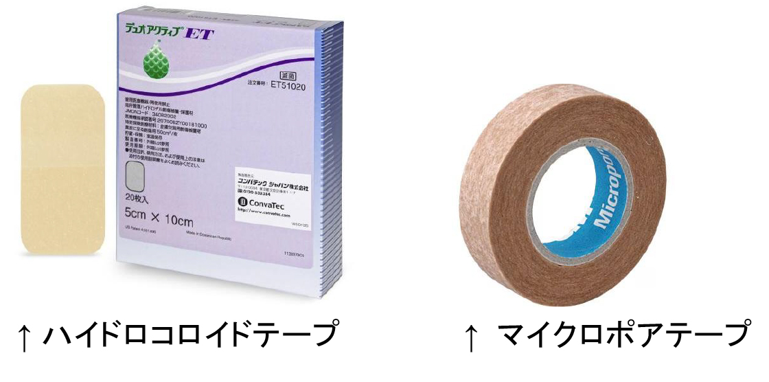 ほくろの場合